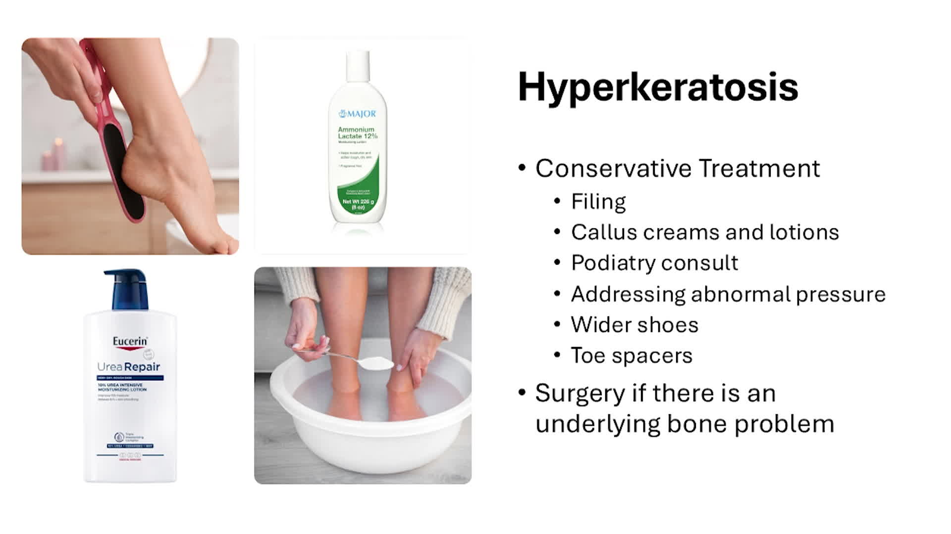 Thumbnail image for Keep Your Feet Healthy